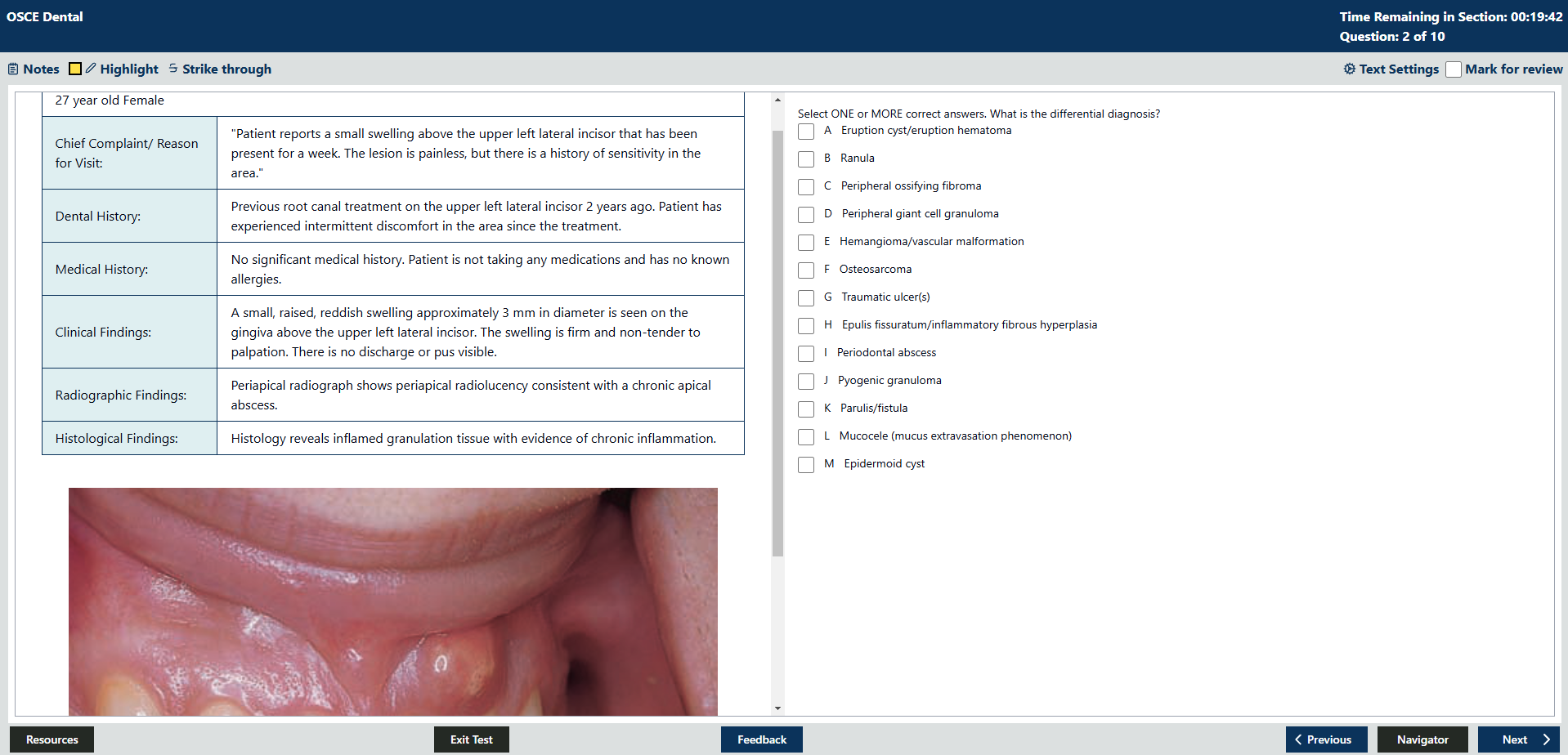 NDEB Virtual OSCE App Question with a Clinical Image - NDEB OSCE QBANK interface screenshot
